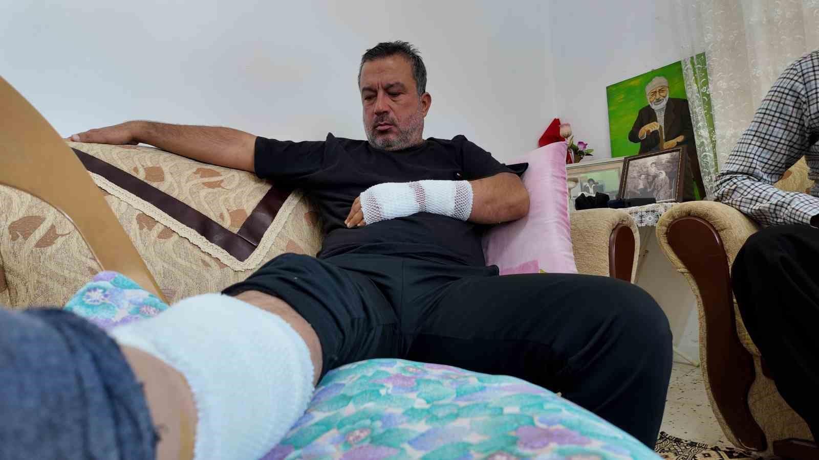 Sahipli köpeğin saldırdığı adam feci şekilde yaralandı